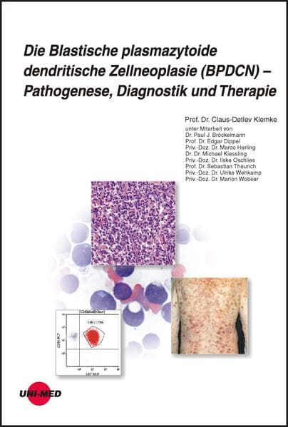 Die Blastische plasmazytoide dendritische Zellneoplasie (BPDCN) - Pathogenese, Diagnostik und Therap