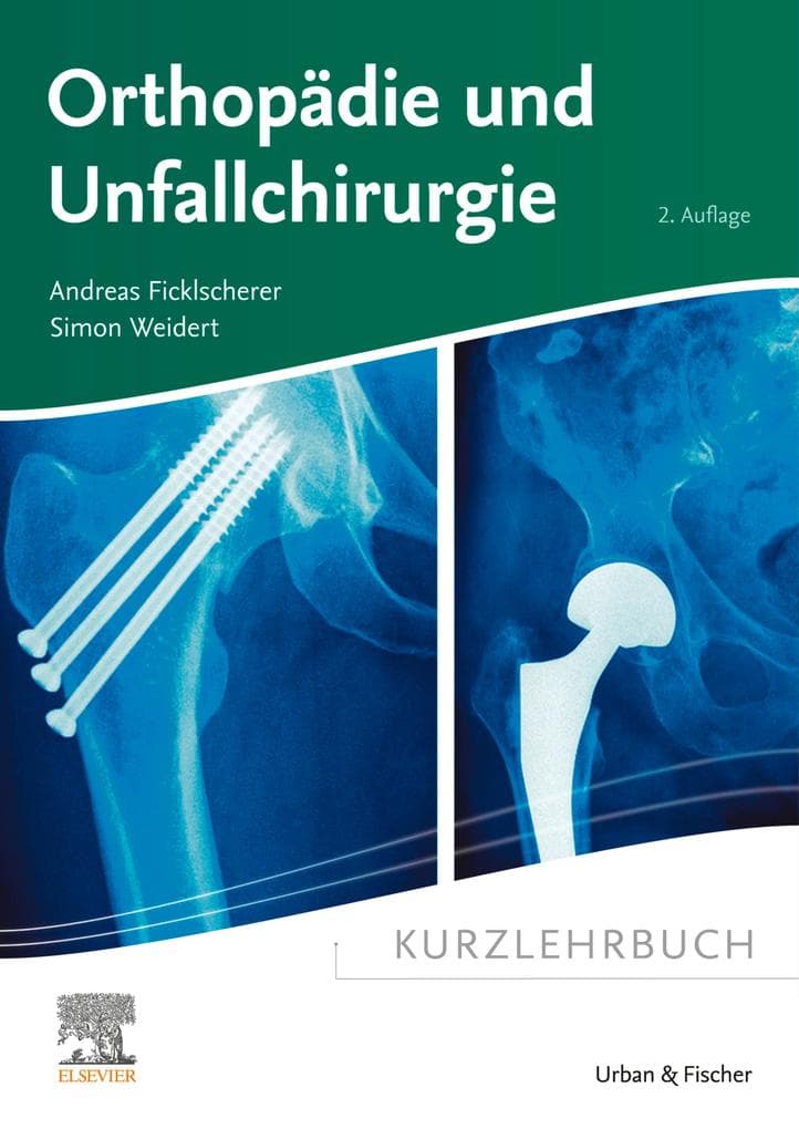 Kurzlehrbuch Orthopädie und Unfallchirurgie