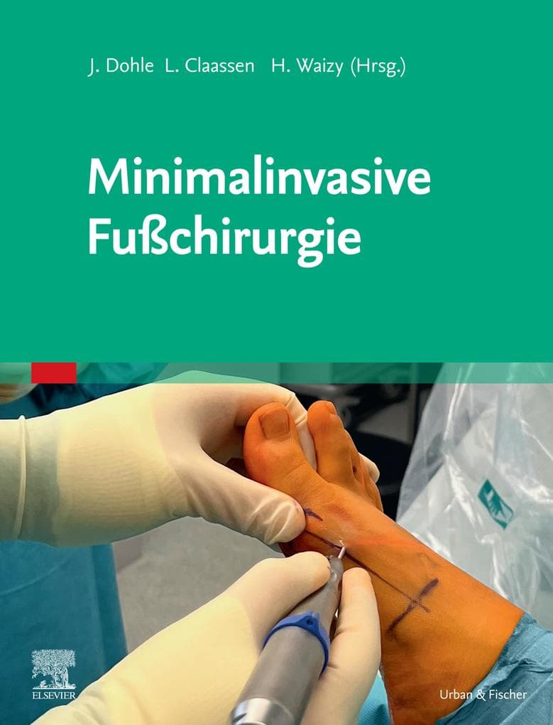Minimalinvasive Fußchirurgie